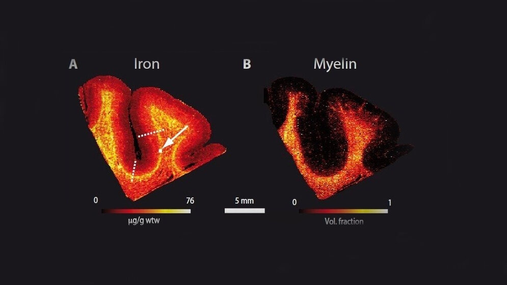 Die_Wissenschaftler_erstellten_hochaufloesende_Karten_MPI_CBS.jpg hochauflösende Karten der Grenze zwischen weißer und grauer Substanz