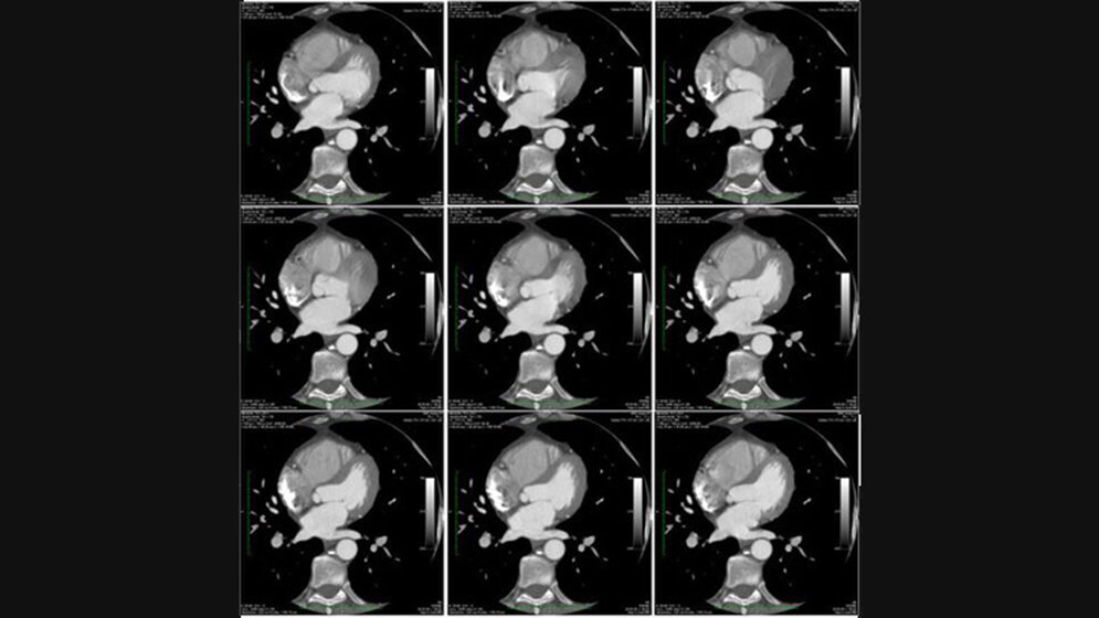 Radiologische Diagnostik