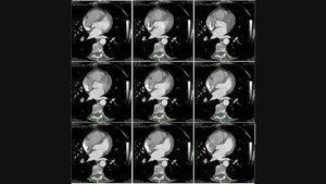 Radiologische Diagnostik