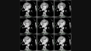 Radiologische Diagnostik