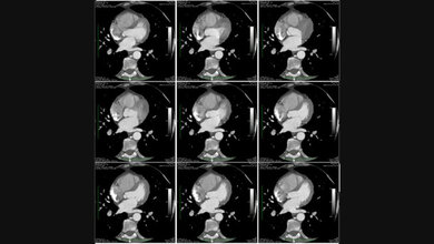 Radiologische Diagnostik