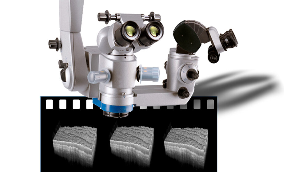 Kopf_eines_Operationsmikroskops_Neuro_OCT.jpg Kopf eines Operationsmikroskops