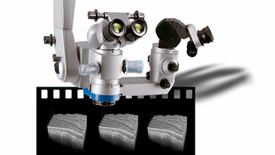 Kopf eines Operationsmikroskops