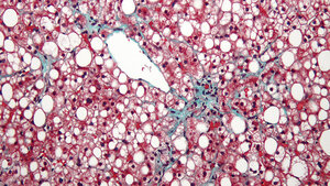 Let’s say it in English