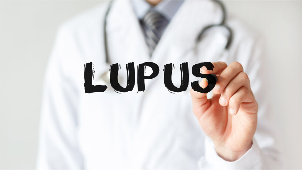 Systemischer Lupus erythematodes (SLE) 
