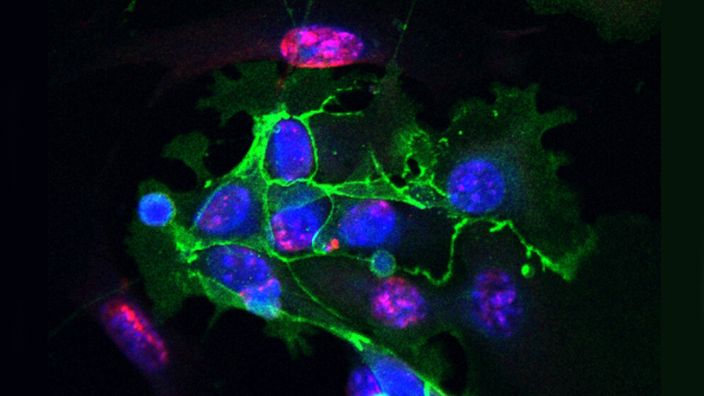 Probe_aus_einer_Lungenfibrose_HZM.jpg Probe aus einer Lungenfibrose