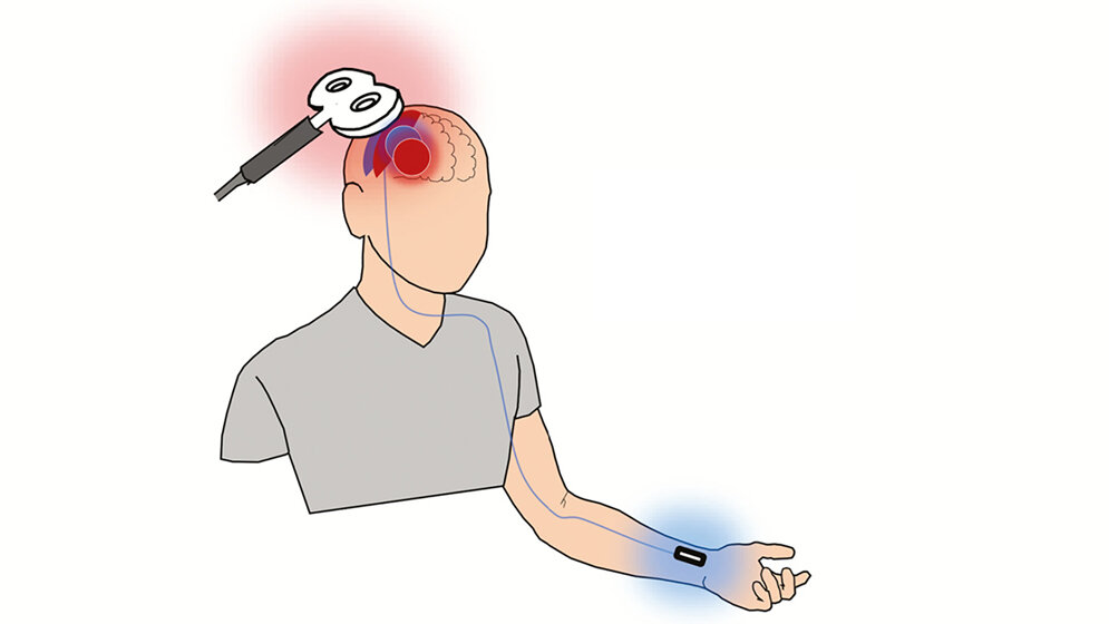 Gleichzeitige Stimulation 