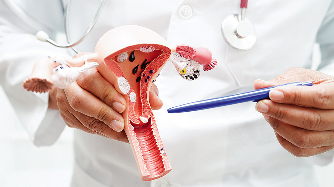 Foto vom Schnittmodell des Gebärmutterhalses