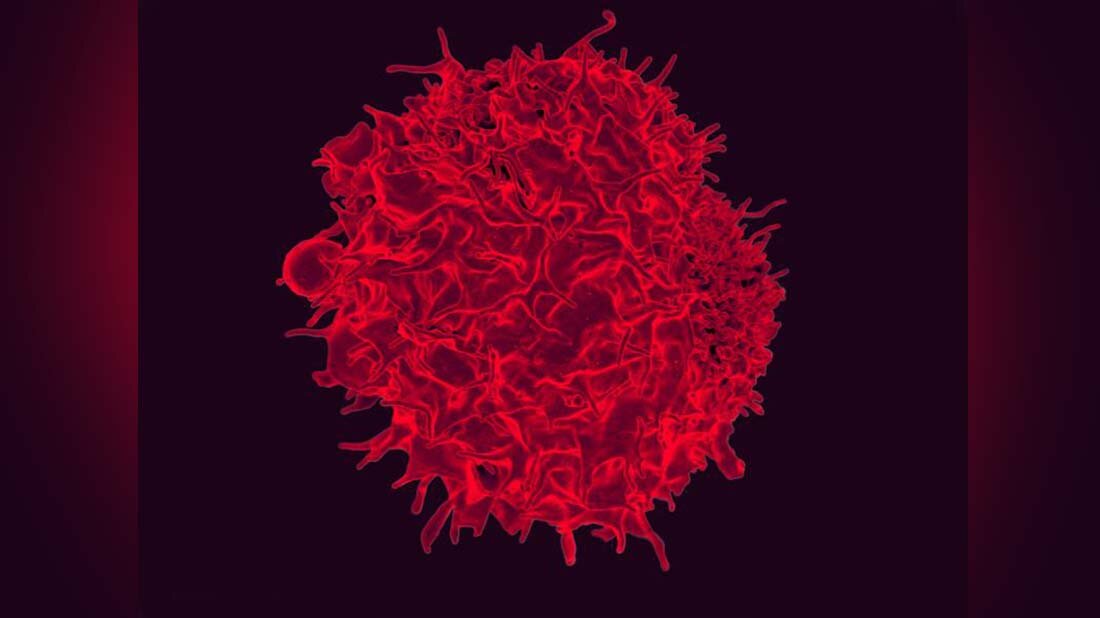 Vielversprechender Therapieansatz gegen Blutkrebs