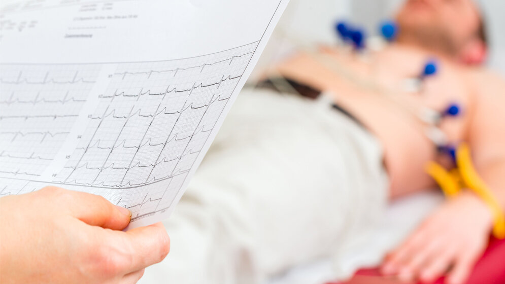 EKG_Kzenon_stock_adobe_com.jpg
