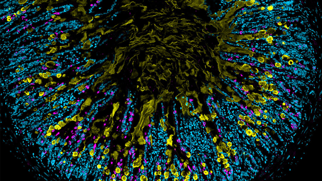 Immunzellen.jpg Zentrale Aufgaben der ILC2 jetzt aufgedeckt