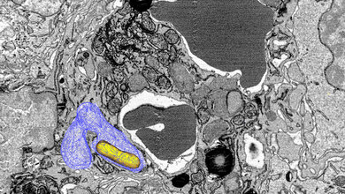 Salmonellen Fresszelle