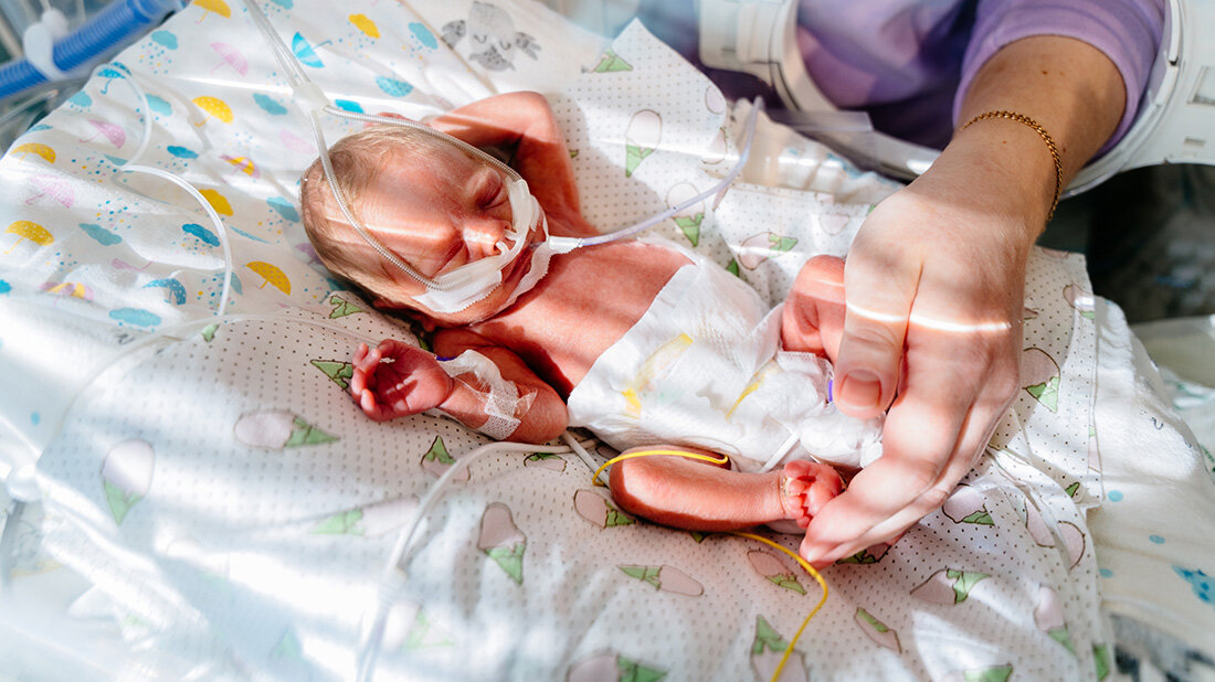 Fruechen_Umbaulunge.jpg Lungenschäden bei Frühchen rechtzeitig erkennen, neue Methode mittels MRT