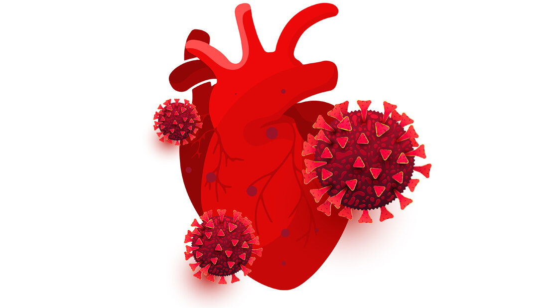 Auswirkungen von COVID-19 auf das Herz