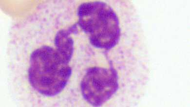 Granulopoese