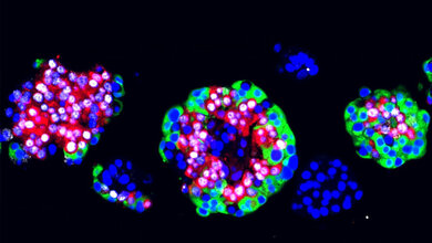 Menschliche Langerhans Inseln
