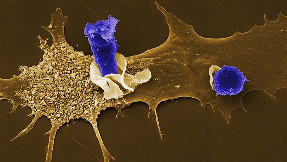 Eine menschliche dendritische Zelle