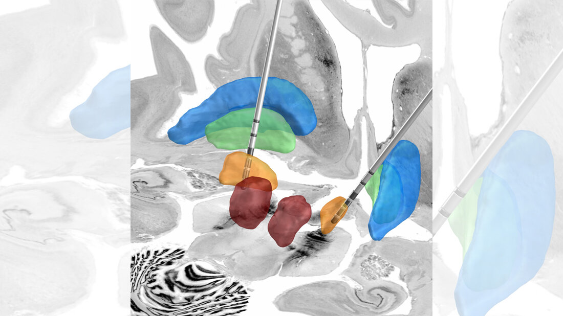 Neue Software zur Einstellung entwickelt
