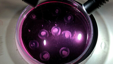 Drug Delivery System GlioGel 