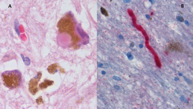 Histologische Probe von Substantia nigra 