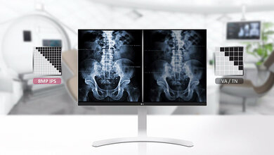 Foto des LG Cloud Device