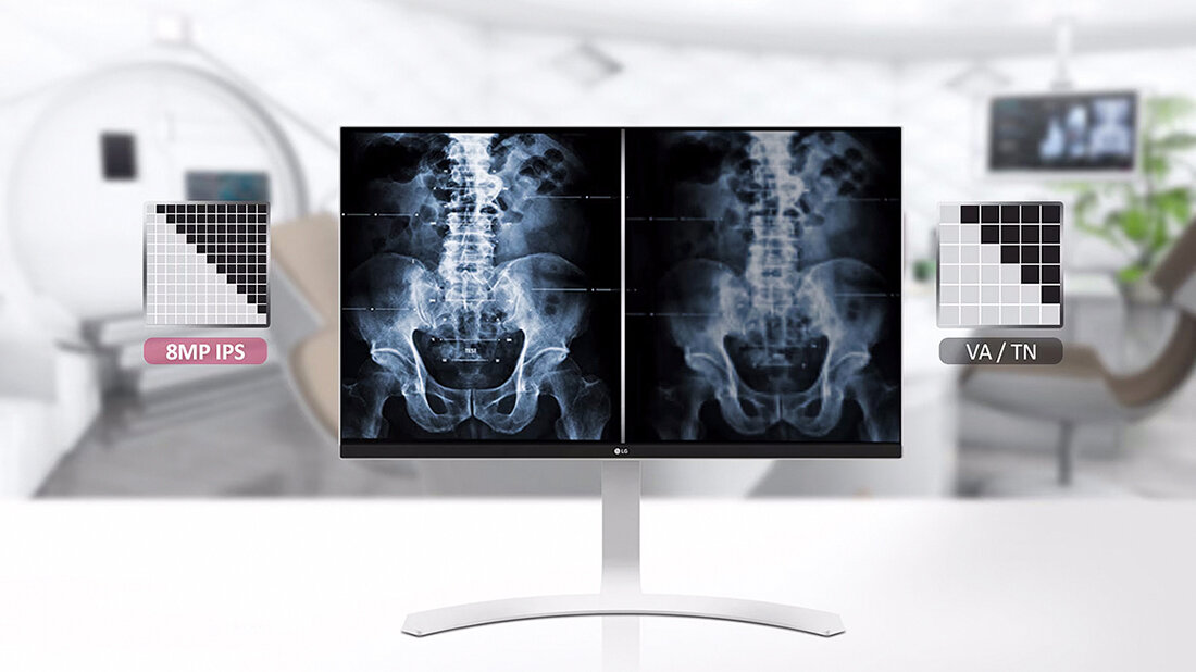 Foto des LG Cloud Device