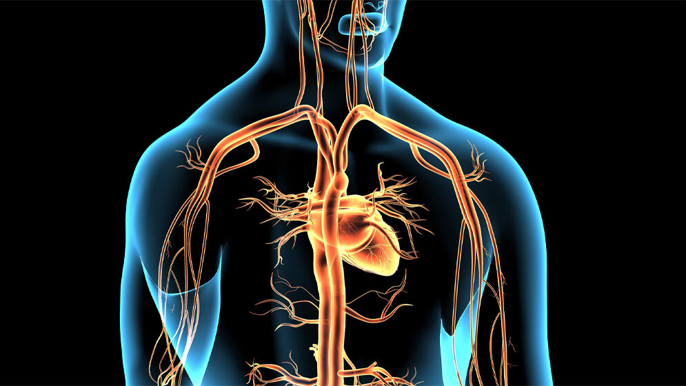 Die Computertomografie des Herzens (Cardio-CT)
