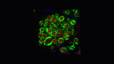 Trapezkörper und Myelinschicht