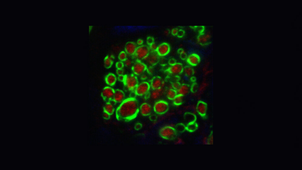 Trapezkörper und Myelinschicht