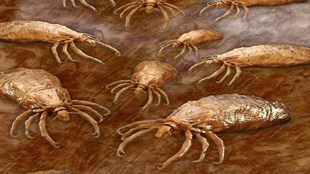 Läuserückfallfieber