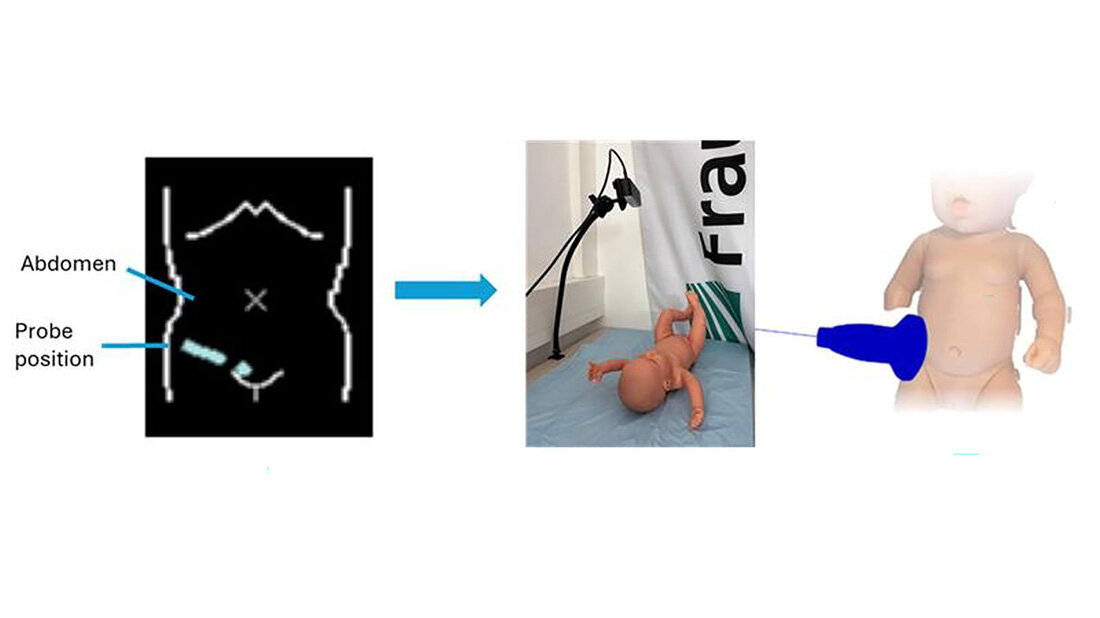 Schnellere_Ultraschalluntersuchung.jpg Schematische Darstellung des neuen Systems.