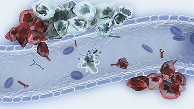 Liquid Biopsy