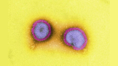 Influenza-Viren