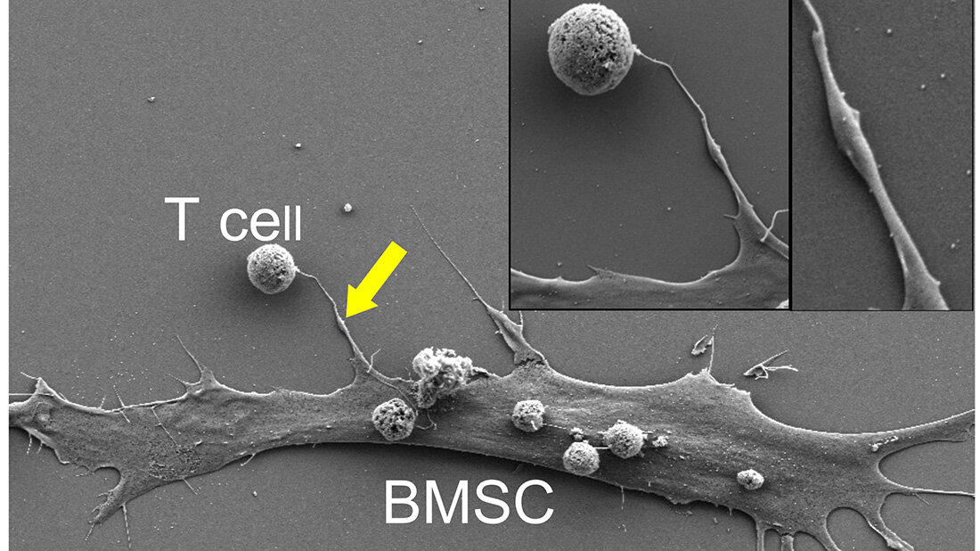 Nanotube_Knochenmarkzelle_T-Zelle.jpg Nanotube Knochenmark-Stromazelle, T-Zelle