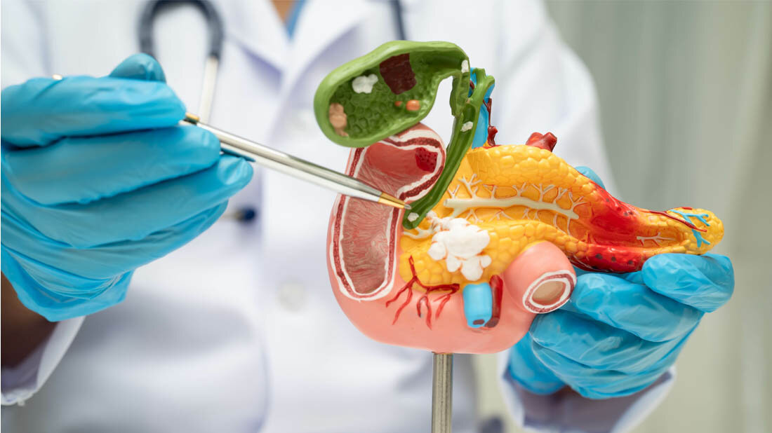 Pankreas.jpg Pankreasmodell