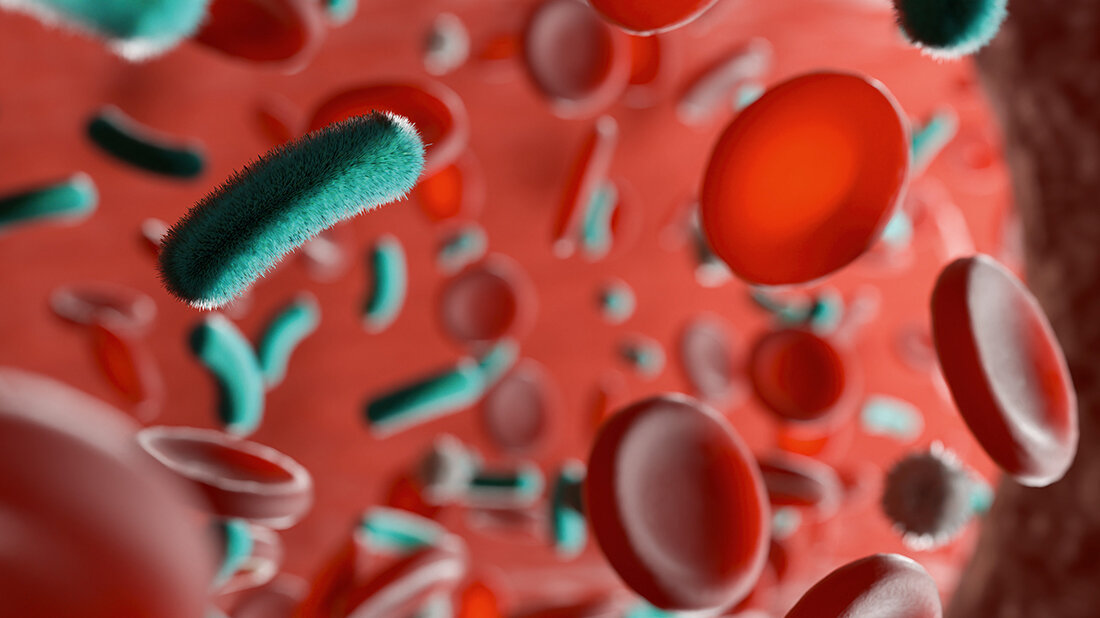 Akute Sepsis bei zuvor gesunden Patientinnen und Patienten: Ist das Risiko vorauszusehen? Grafische Visualisierung verschiedener Blutbestandteile