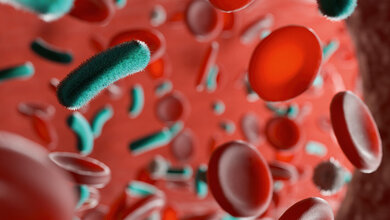 Akute Sepsis bei zuvor gesunden Patientinnen und Patienten: Ist das Risiko vorauszusehen? Grafische Visualisierung verschiedener Blutbestandteile