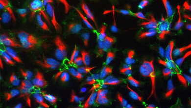 humane neurale Stammzellen