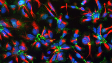 humane neurale Stammzellen