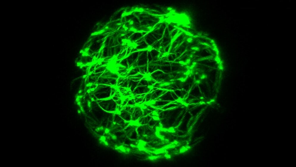 Modell eines zellulären Vesikels