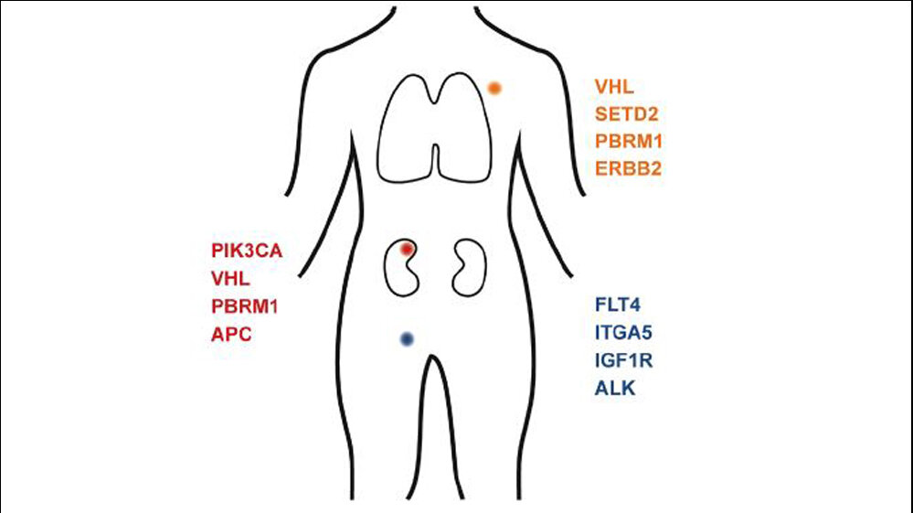 Identifizierte Mutationsmuster im Primärtumor und den Metastasen 