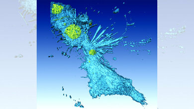 Lungenkrebszellen bei der Zellteilung