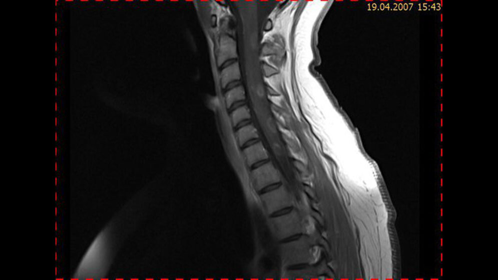 Schnittbilddiagnostik der Wirbelsäule