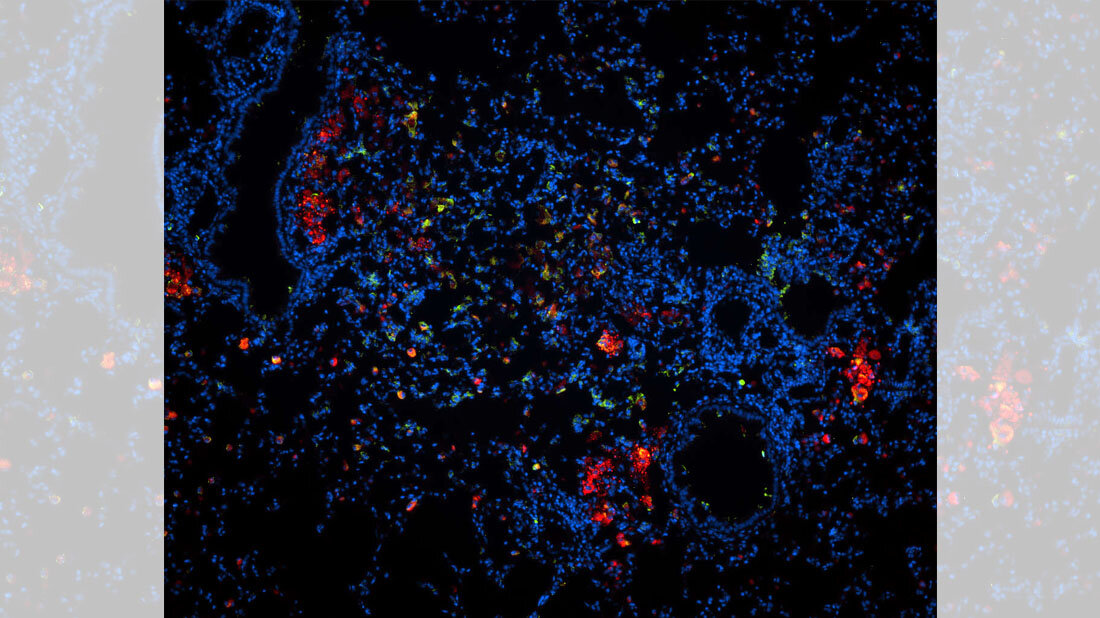 Lungenschnittes einer mit TB infizierten Maus