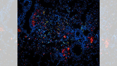 Lungenschnittes einer mit TB infizierten Maus