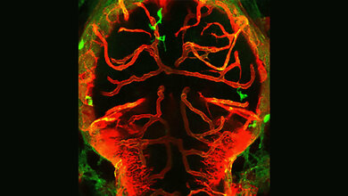 Gehirn eines Zebrafisches mit Makrophagen/Mikroglia