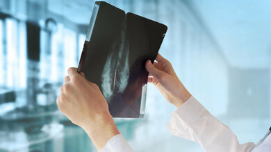 Mammographie-Screening