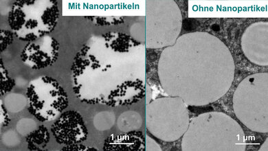 Menschliche_fettzelle_Fraunhofer_IBMT_29042016.jpg Nano-Teilchen