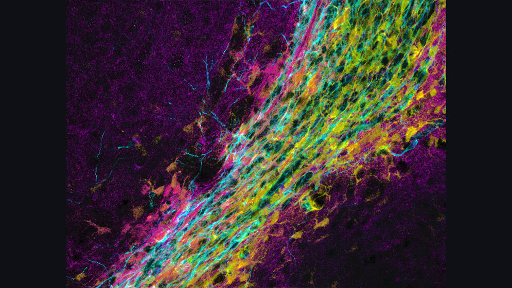 Neuronale_Vorlaeuferzellen_wandern_aus_der_subependymalen_Zone_zum_Riechkolben_HZM_Jacob_Kjell.jpg Neuronale Vorläuferzellen