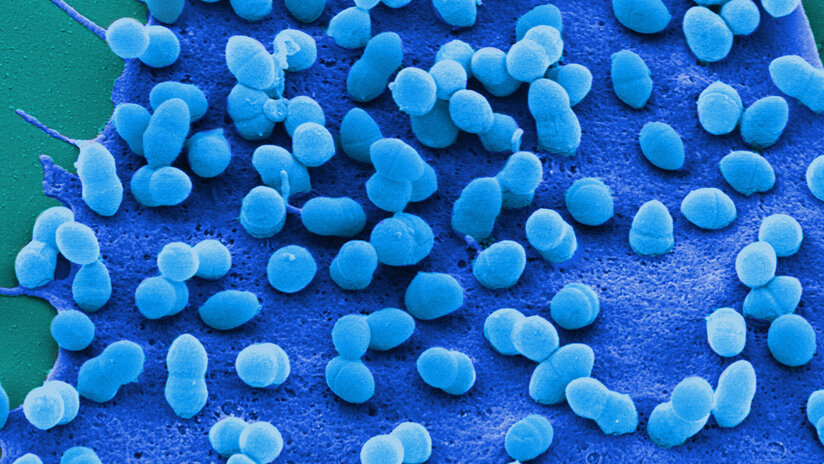 Streptococcus pneumoniae